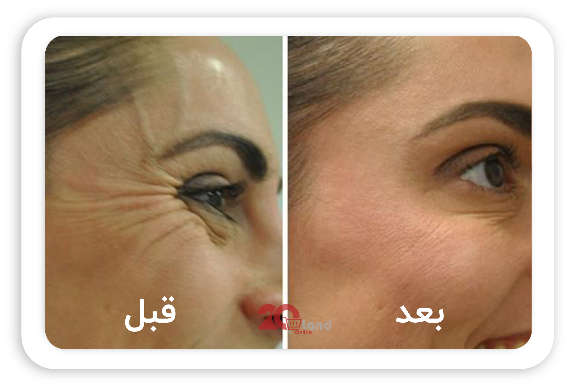 کرم رفع چین و چروک گلاما