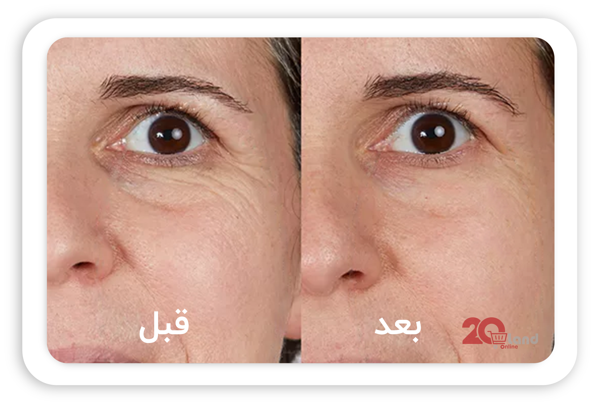 3کرم رفع چین و چروک گلاما