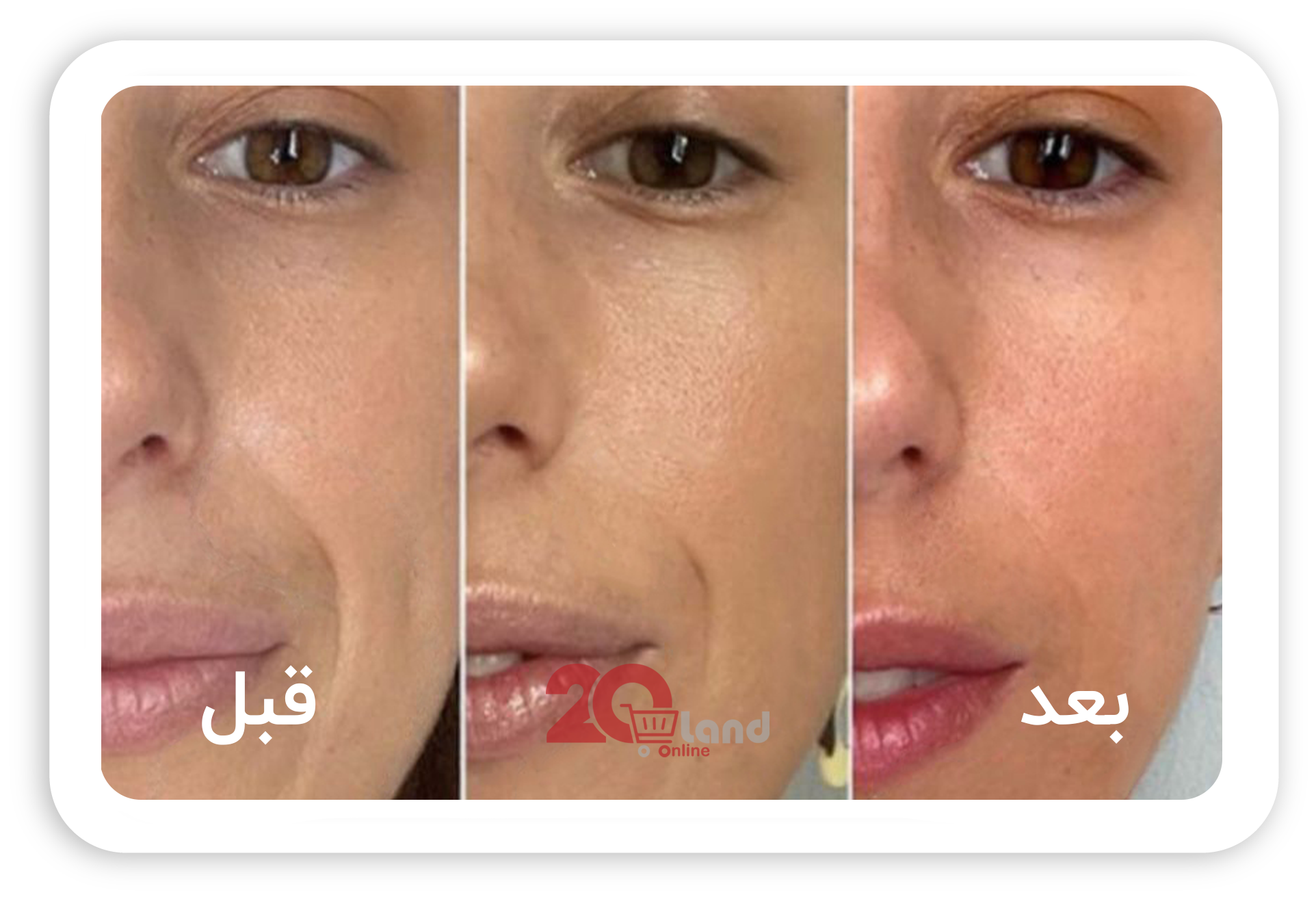 4کرم رفع چین و چروک گلاما