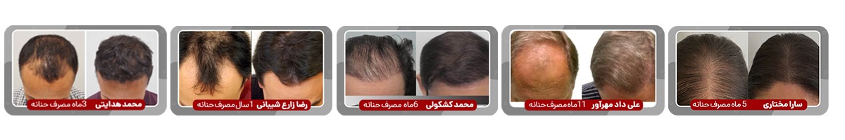 بیستلند شاپ